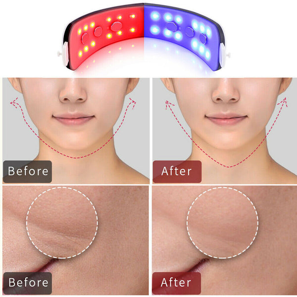 Vibration V-Face Shaping Slimming Tightening Skin Face Lifting Therapy Massager