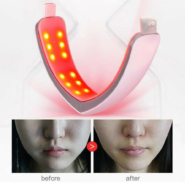 Vibration V-Face Shaping Slimming Tightening Skin Face Lifting Therapy Massager
