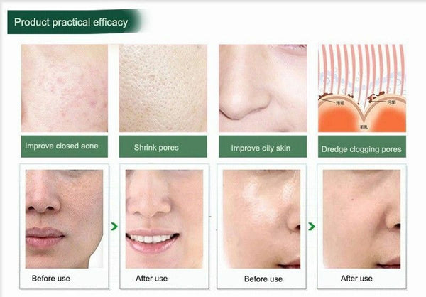 Facial Diamond Peeling Device Spa Anti Aging Dermabrasion Skin Deep Clean Pores
