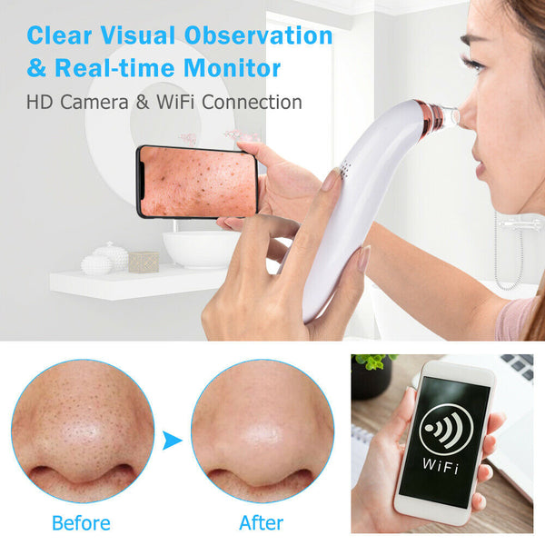 Visual Blackhead Remover Wifi Camera Pore Vacuum Suction Face Nose Acne Cleaner