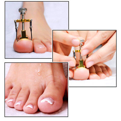 Ingrown Toenail Straightening Correction Tools Foot Nails Pasters Kit Flower