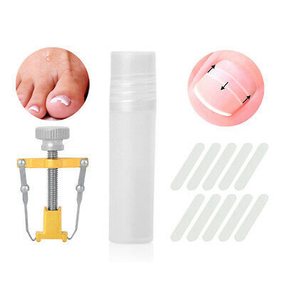 Ingrown Toenail Straightening Correction Tools Foot Nails Pasters Kit Flower
