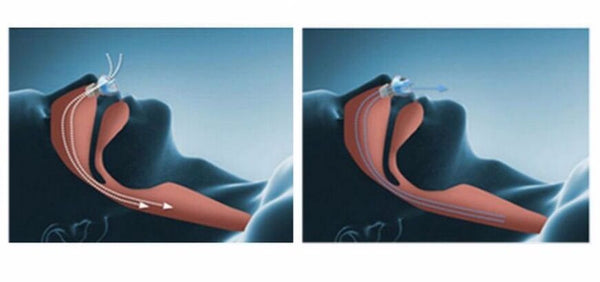 Clean Nose Air filter Breath Breathing Dust Filter Anti Snoring Good Sleeping