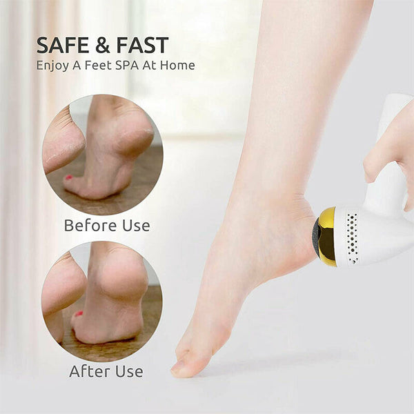 Powerful Electric Foot File Grinder Callus Dead Skin Remover Pedicure Scrubber