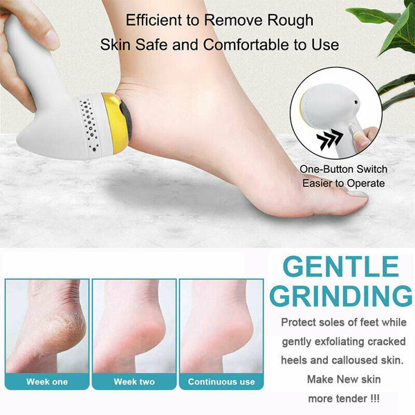 Powerful Electric Foot File Grinder Callus Dead Skin Remover Pedicure Scrubber