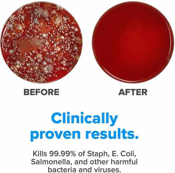 UV Ultraviolet Mobile Phone Cleaner Kill Virus Sterilizer Sanitizer Disinfection